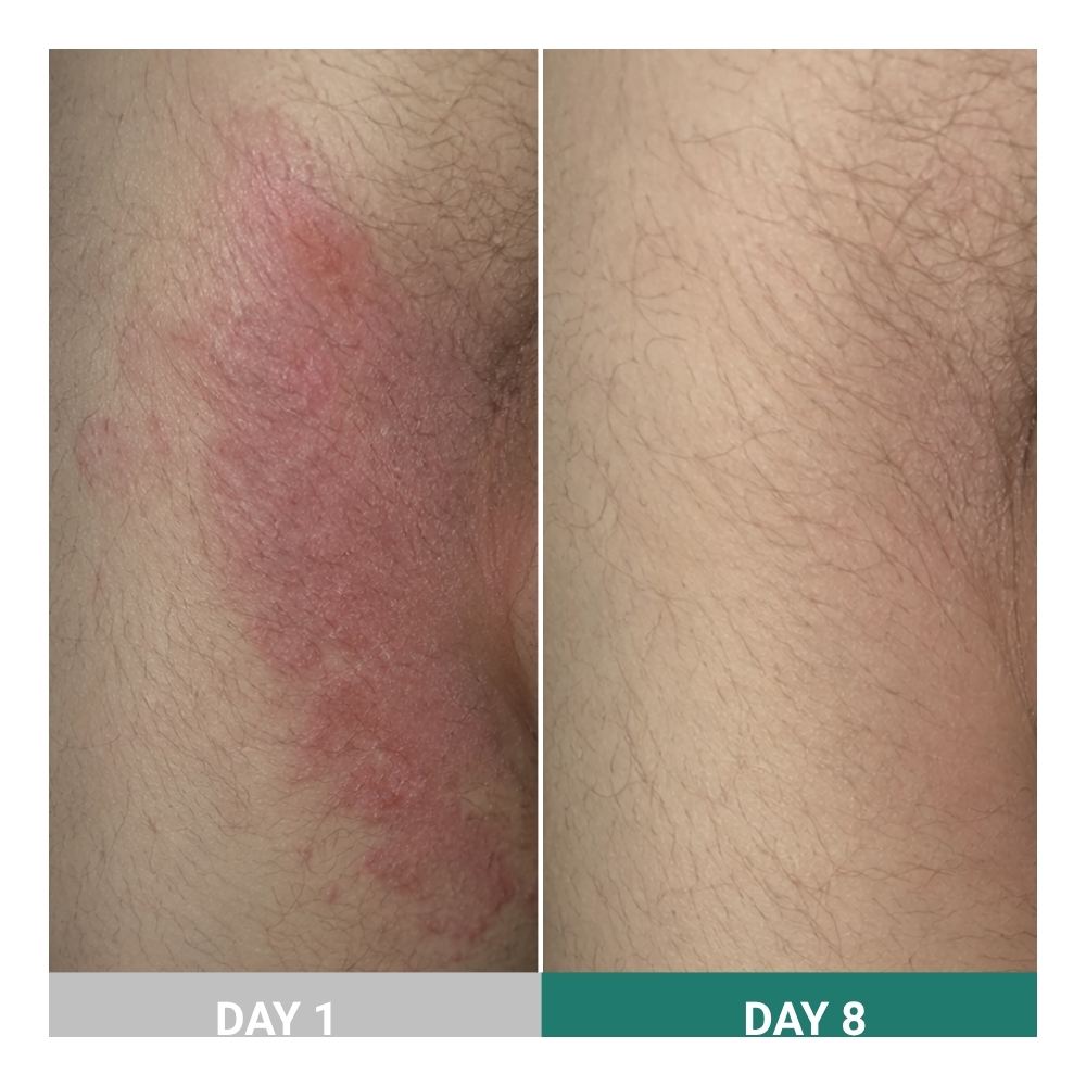 SkinSnow result