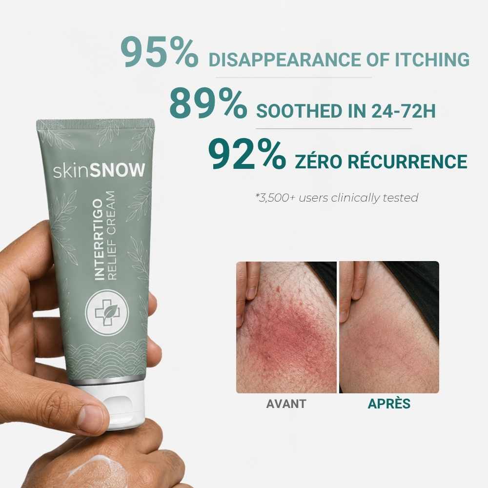 SKIN RELIEF CREAM