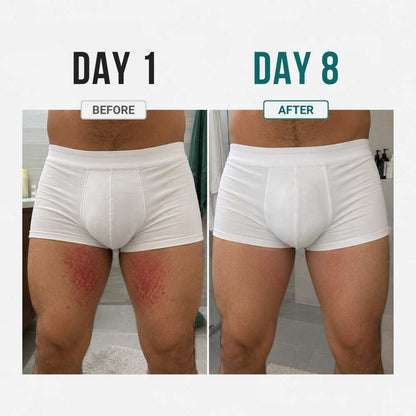 SKIN RELIEF CREAM