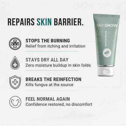 SKIN RELIEF CREAM