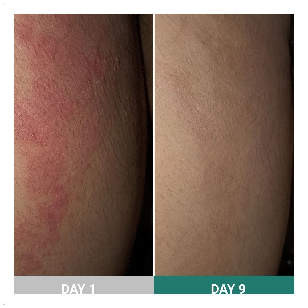 SkinSnow result