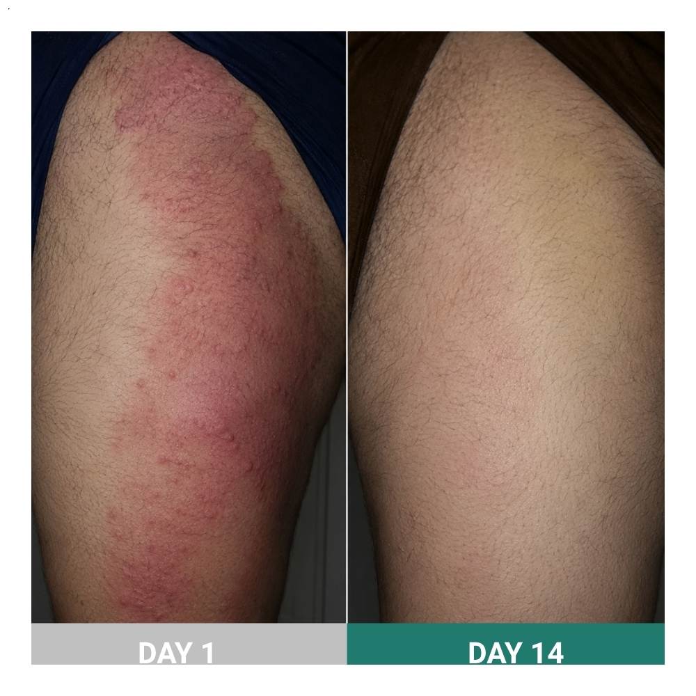 SkinSnow result